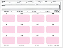 ECF-ECG MOUNTING FORM ECF 2301 ECG MOUNT SHEET 8-1/2 X 11